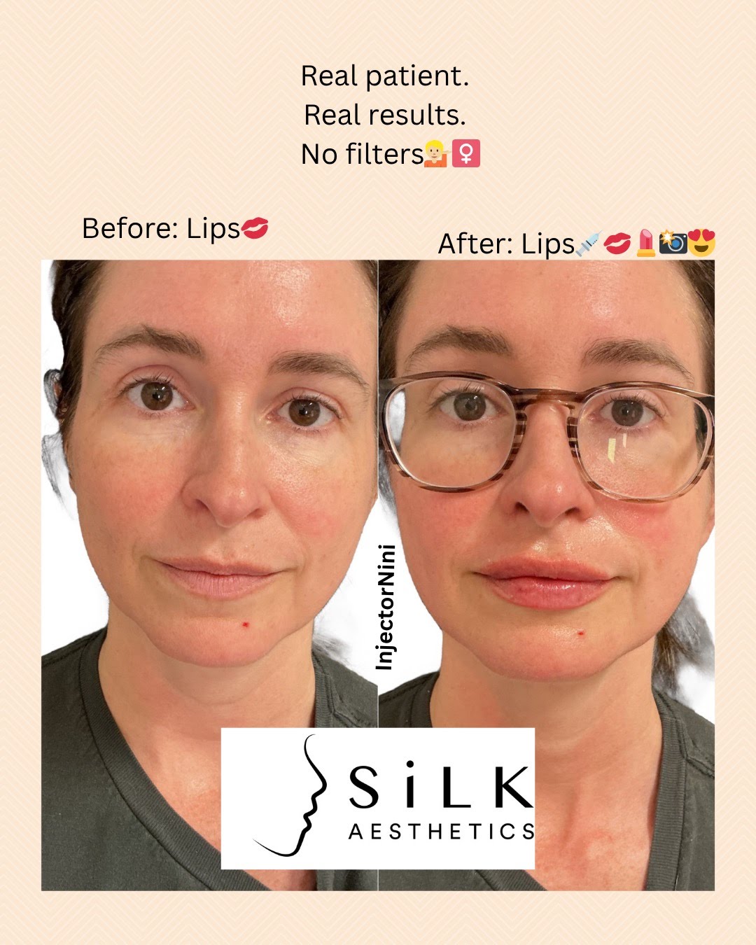 336ec5317721cc3ad9a2fb80b633761863a4254c-1